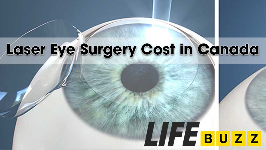 Laser Eye Surgery Cost In Canada: The Complete Guide