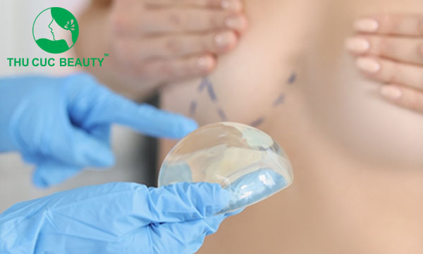 Phẫu thuật nâng ngực: Quy trình thực hiện và quá trình phục hồi - Bệnh viện Thẩm mỹ Thu Cúc