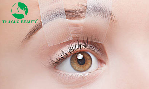 Cảnh báo tác hại của tiêm botox xóa nhăn đuôi mắt - Bệnh viện Thẩm mỹ Thu Cúc