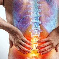 Need Treatment for Sciatica Pain? Try Riva Clinic