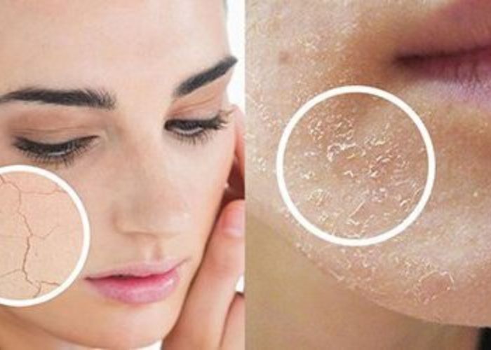 Da khô do điều hòa? Cách cấp ẩm tại nhà như spa với skincare chuẩn chuyên gia
