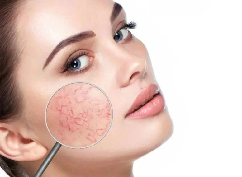 Da mặt mỏng có nên tẩy tế bào chết không? Tại sao?
