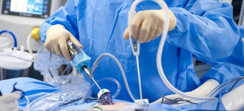 Best Laparoscopic Gynecologist in Delhi | Sunrise Hospital