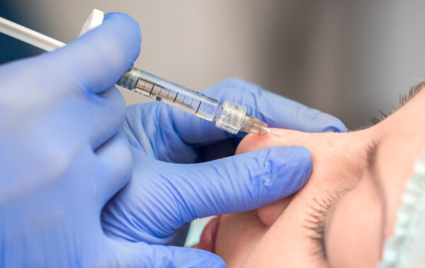 Tiêm filler mũi giữ được bao lâu? Tại sao không nên tiêm filler mũi? - Bệnh viện Thẩm mỹ Thu Cúc