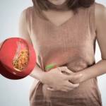 Best Gallstone Treatment in Bharatpur