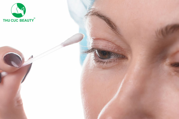Bôi thuốc chống sẹo sau cắt mí bao lâu? - Bệnh viện Thẩm mỹ Thu Cúc
