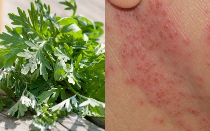 Làm Đẹp Bằng Ngải Cứu: Bí Quyết Toàn Diện Cho Làn Da Khỏe Đẹp – Newway - Thương hiệu uy tín hàng đầu trong lĩnh vực dược mỹ phẩm