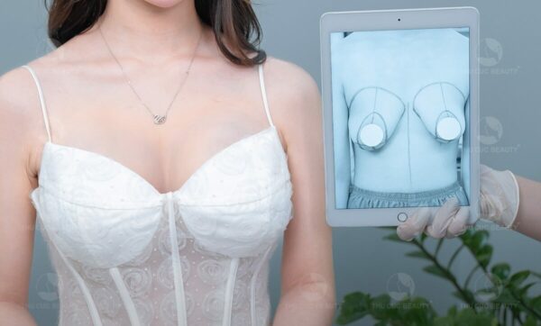 Treo ngực sa trễ có ảnh hưởng gì không? - Bệnh viện Thẩm mỹ Thu Cúc