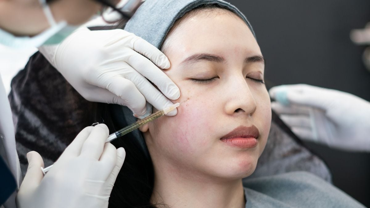 Công nghệ PRP trẻ hóa da: