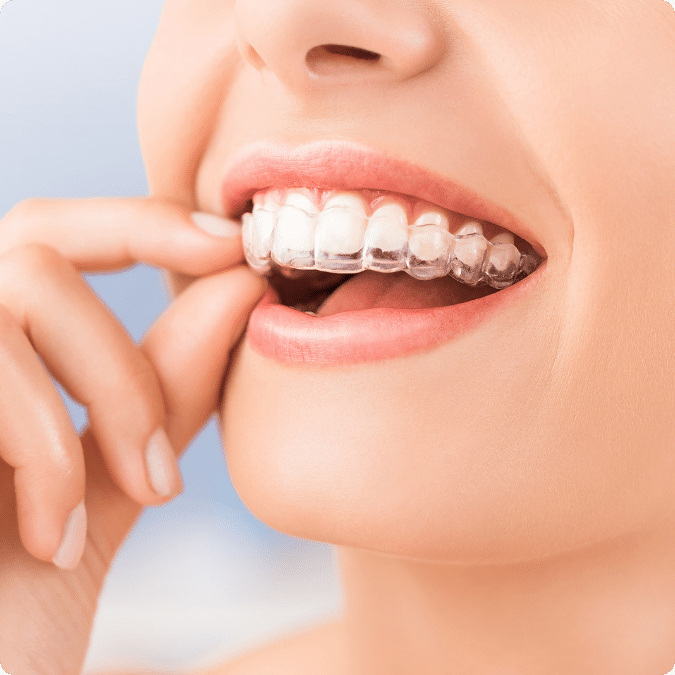 Cosmetic Dentistry - MYO Medical Center