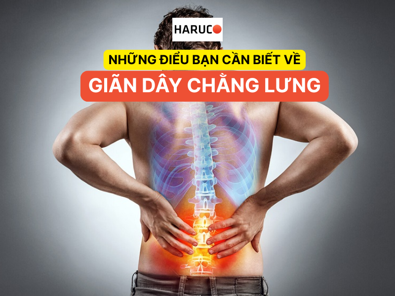 Những điểu bạn cần biết về giãn dây chằng lưng