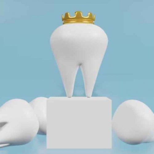 Dental Crown Ajman | Strong & Natural-Looking Crowns