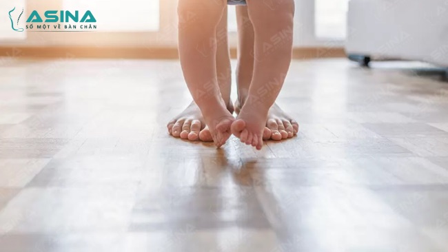 Hướng dẫn cách chữa chân vòng kiềng cho bé từ chuyên gia