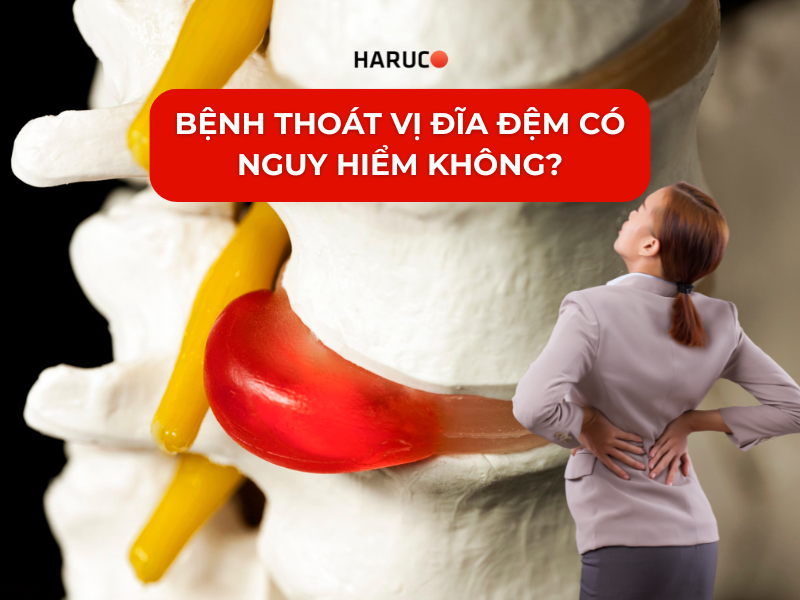 Bệnh thoát vị đĩa đệm có nguy hiểm không? Cách phòng ngừa