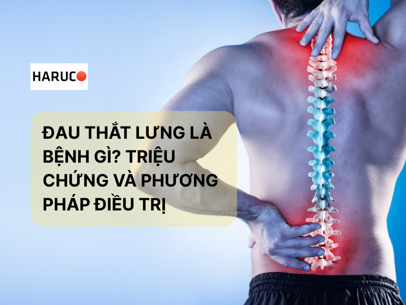 Đau thắt lưng là bệnh gì? Triệu chứng và phương pháp điều trị