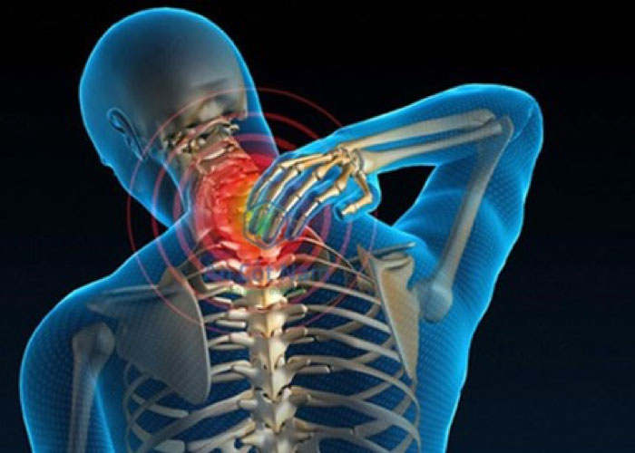 Thoái hóa đốt sống cổ: Dấu hiệu, Nguyên nhân và cách phòng ngừa