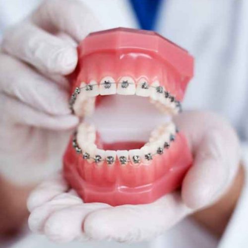 Best Orthodontist in Ajman | Expert Braces and Dental Care