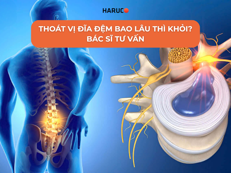 Thoát vị đĩa đệm bao lâu thì khỏi? Bác sĩ tư vấn