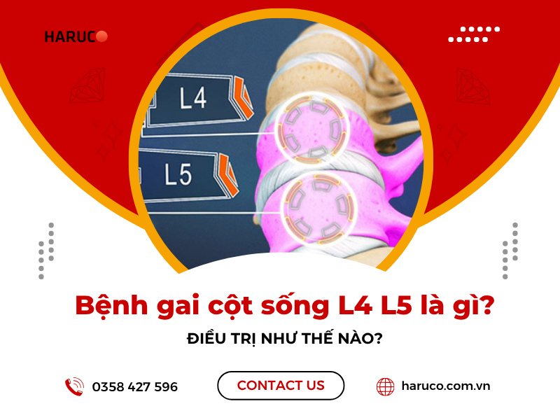 Bệnh gai cột sống L4 L5 là gì? Điều trị như thế nào?