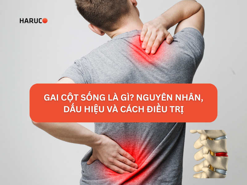 Gai cột sống là gì? Nguyên nhân, dấu hiệu và cách điều trị
