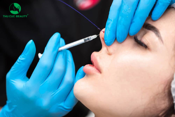 Nên nâng mũi bằng chỉ hay tiêm filler? - Bệnh viện Thẩm mỹ Thu Cúc