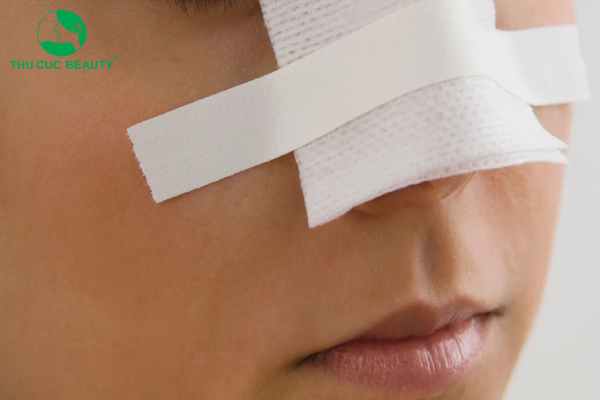 Nâng mũi sau bao lâu thì làm lại được? - Bệnh viện Thẩm mỹ Thu Cúc