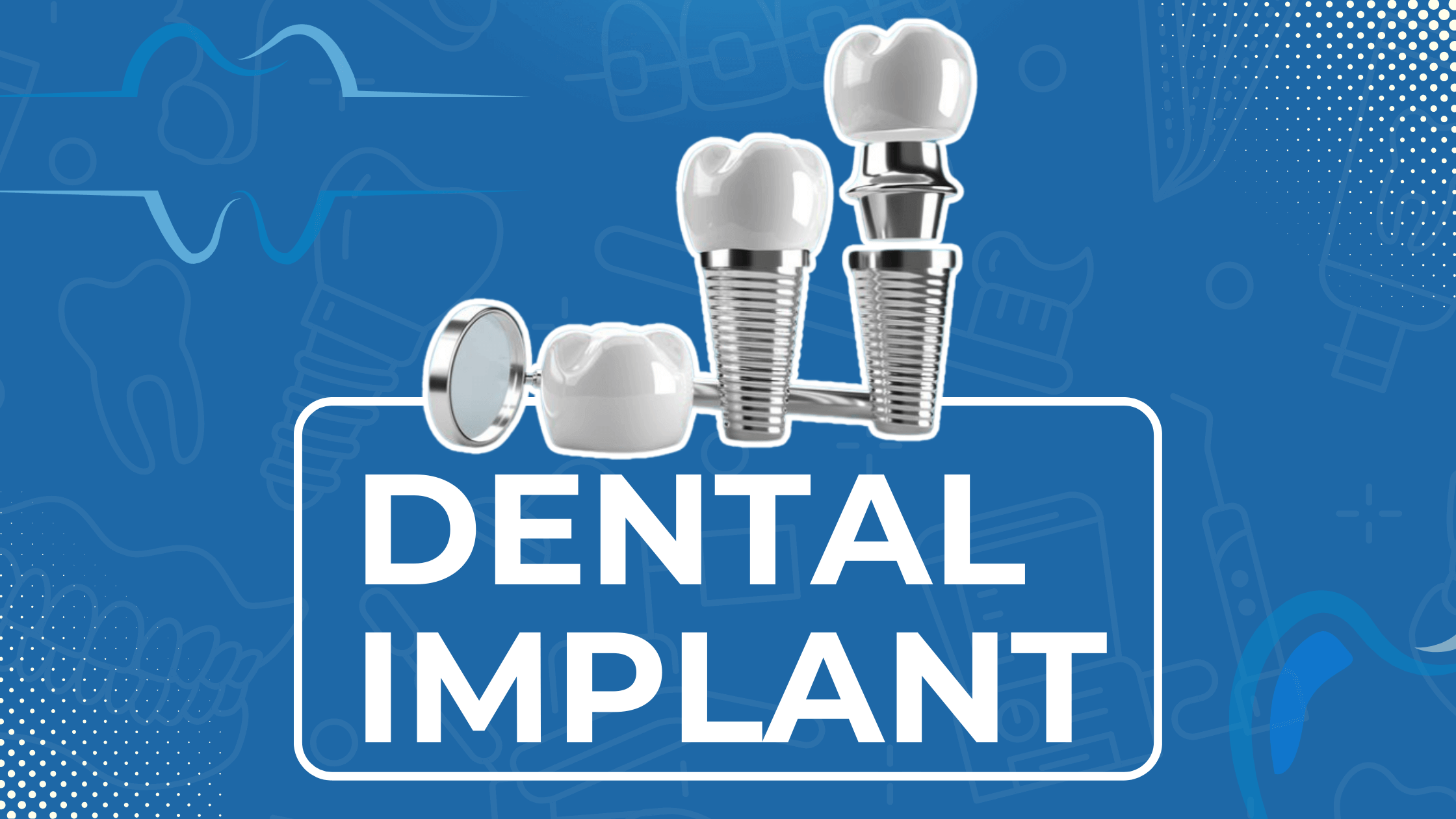 Best Dental Implant Hospital in Jaipur - Free Consult Now