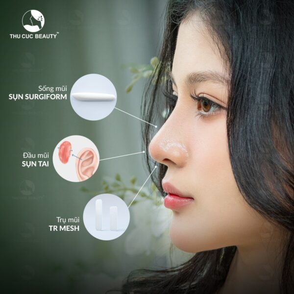 Nâng mũi không bọc đầu mũi có sao không? - Bệnh viện Thẩm mỹ Thu Cúc