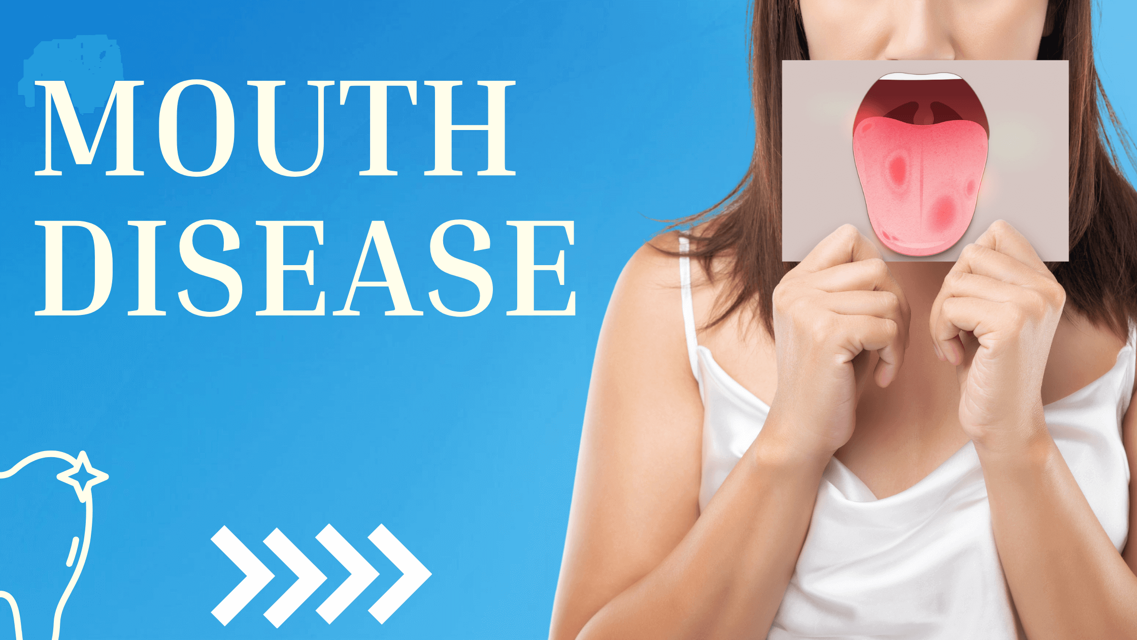 Mouth Disease Treatment in Jaipur at Best Price
