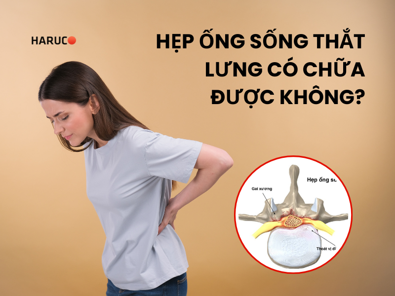Hẹp ống sống thắt lưng có chữa được không?