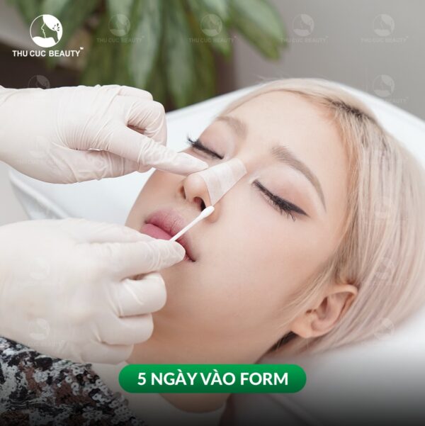 Nâng mũi bao lâu thì vào form? Làm thế nào để nhanh vào form? - Bệnh viện Thẩm mỹ Thu Cúc