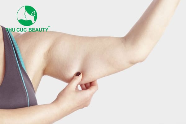Giá hút mỡ bắp tay bao nhiêu tiền? - Bệnh viện Thẩm mỹ Thu Cúc