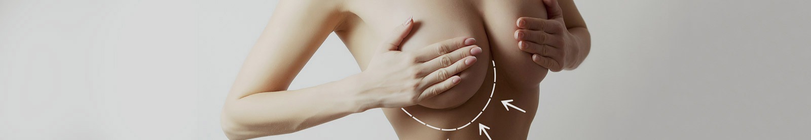 Breast Lift Surgery in Cape Town, South Africa | Your Breasts