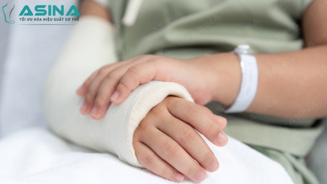 Giải đáp: Sau khi tháo bột tay nên làm gì để nhanh hồi phục?