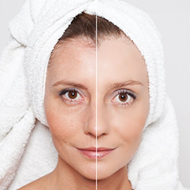 Hyper Pigmentation Treatment: For Unequal Skin Tone. Article - ArticleTed -  News and Articles