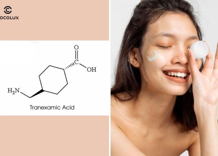 Tranexamic Acid trong mỹ phẩm: Công dụng với nám da đến đâu?