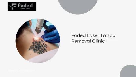 Faded Laser Tattoo Removal Clinic