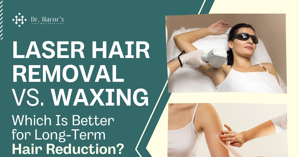 Laser Hair Removal Vs. Waxing: Which Is Better for Long-Term Hair Reduction?