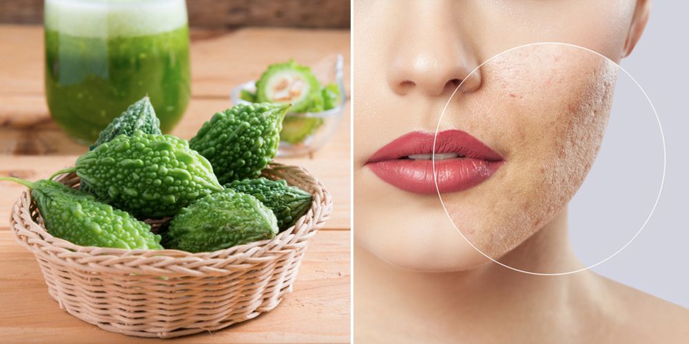 Tổng hợp các công thức làm đẹp từ mướp đắng an toàn