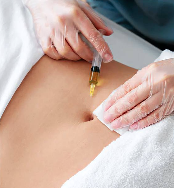 Fat Dissolving Injection – Advanced Non-Surgical Fat Reduction in the UAE