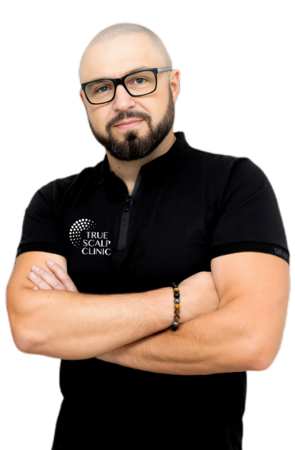 Scalp Micropigmentation Milton Keynes | Hair Tattoo for Men