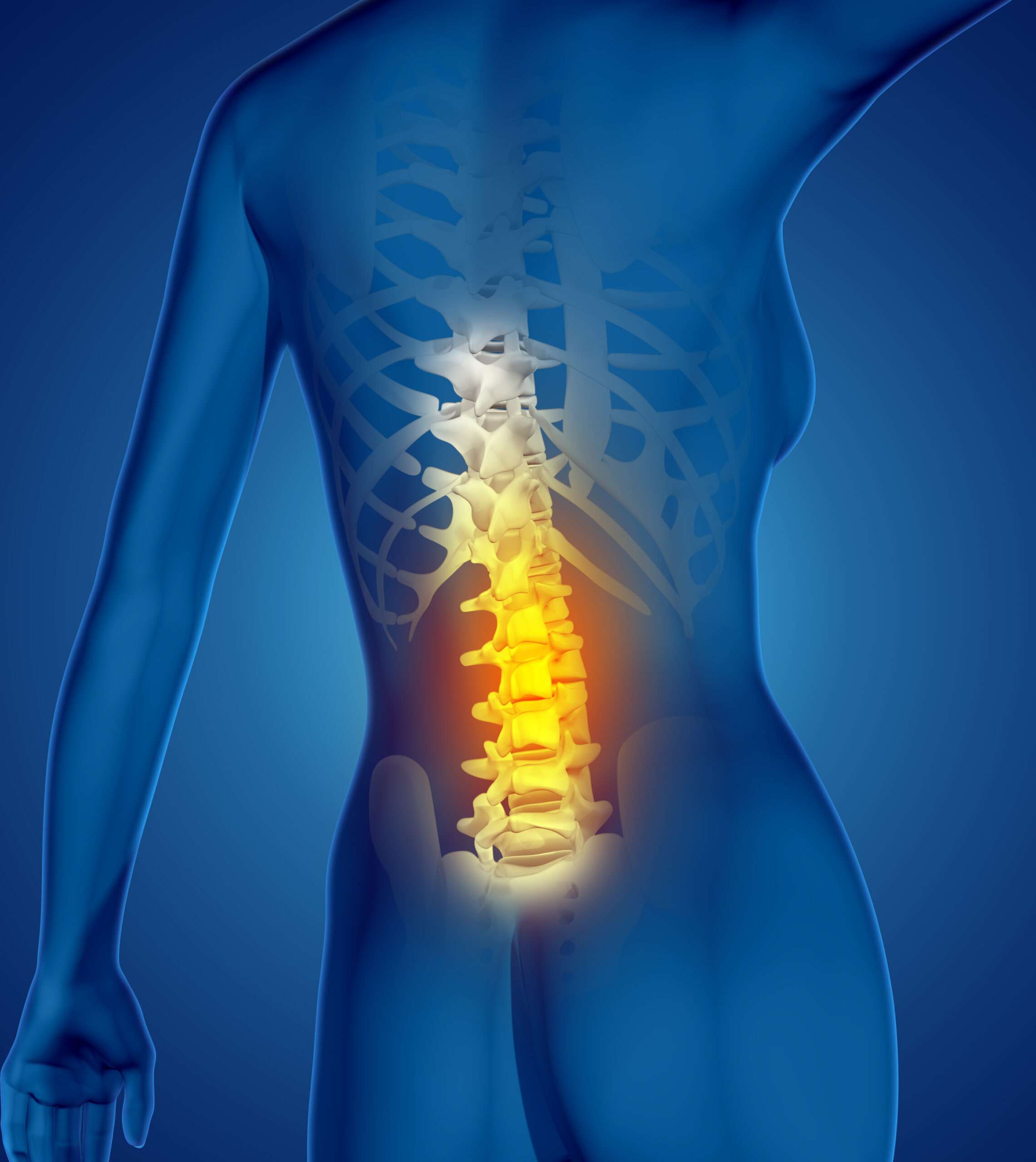 resolvechiro
