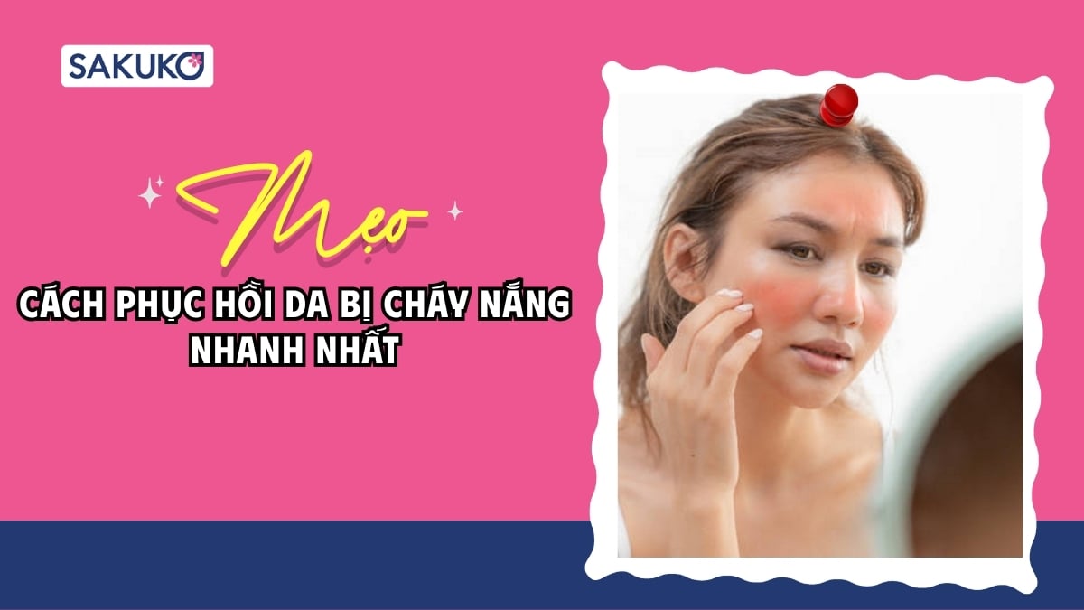 4 cách phục hồi da bị cháy nắng nhanh nhất bằng nguyên liệu tự nhiên