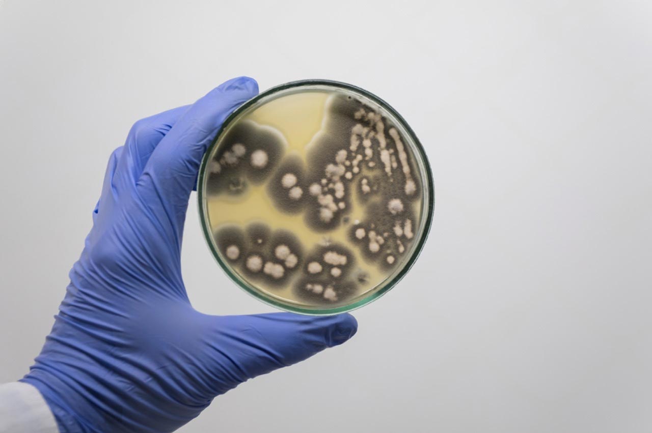 Mold Inspection Near Me | Philadelphia & Nearby | MSI